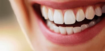 Teeth Whitening Imaging